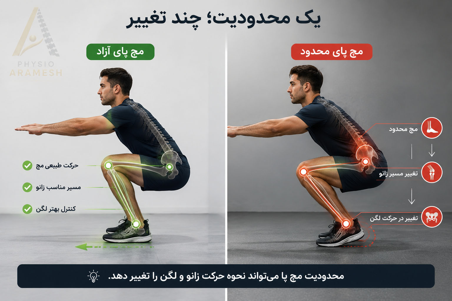 عوارض نقص در زنجیره حرکتی بیومکانیکی